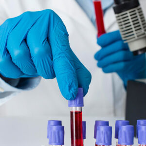 Diplomado Internacional en Hematología