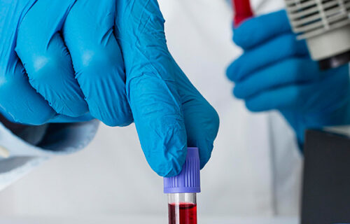 Diplomado Internacional en Hematología